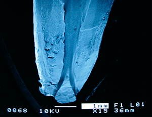 Figure 3: Microscopic image of root canal